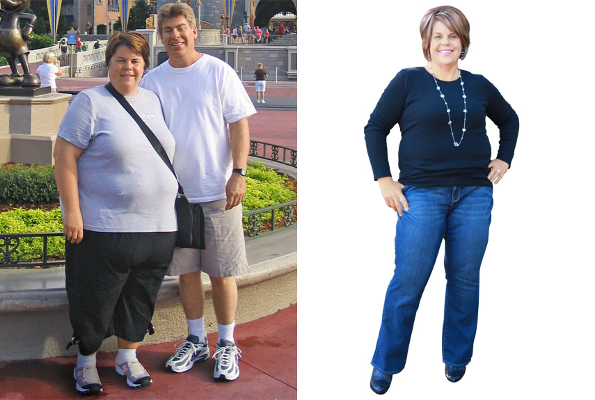 I Lost 195 Pounds Weight Loss Success Story